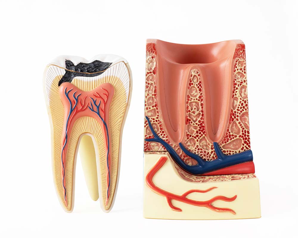 How to Prevent Tooth Decay