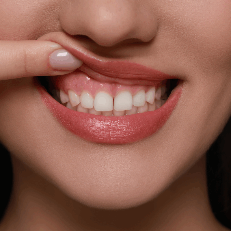 The Role of Collagen in Gum Regeneration and Oral Healing