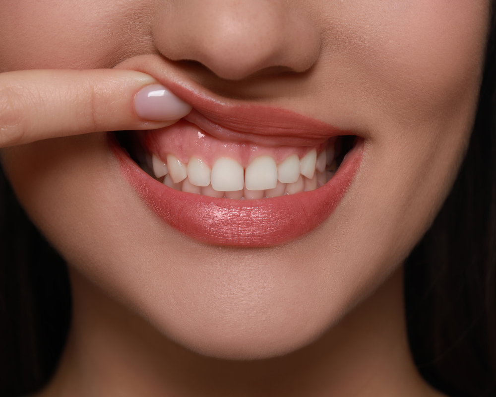 The Role of Collagen in Gum Regeneration and Oral Healing