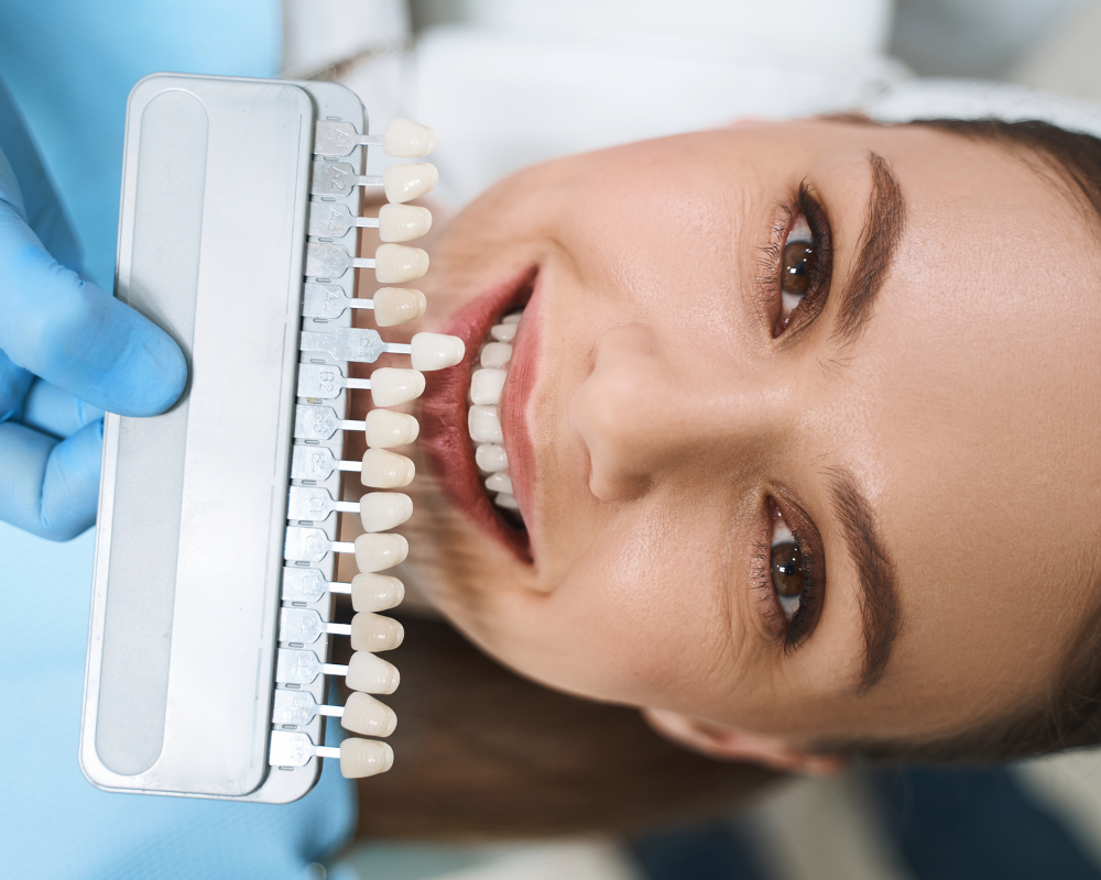 Discover the Power of No-Drill Veneers for a Beautiful, Natural Smile