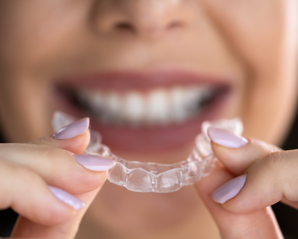 Straighten Your Smile Naturally with Clear Aligners in Clearwater