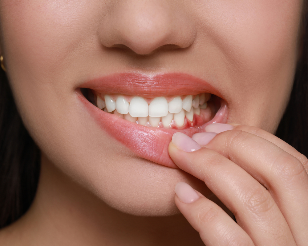Teeth Sensitivity Relief: Natural, gentle solutions that actually work