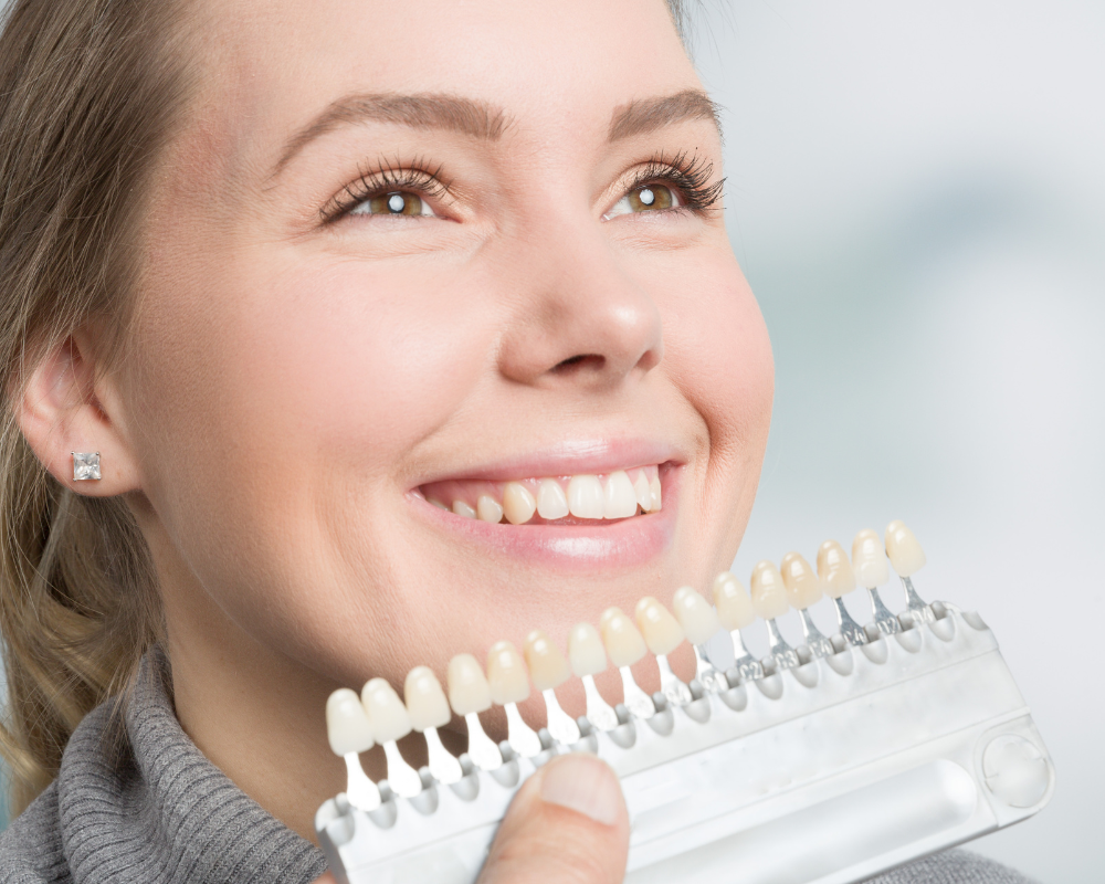 Are Drilless Veneers Permanent?